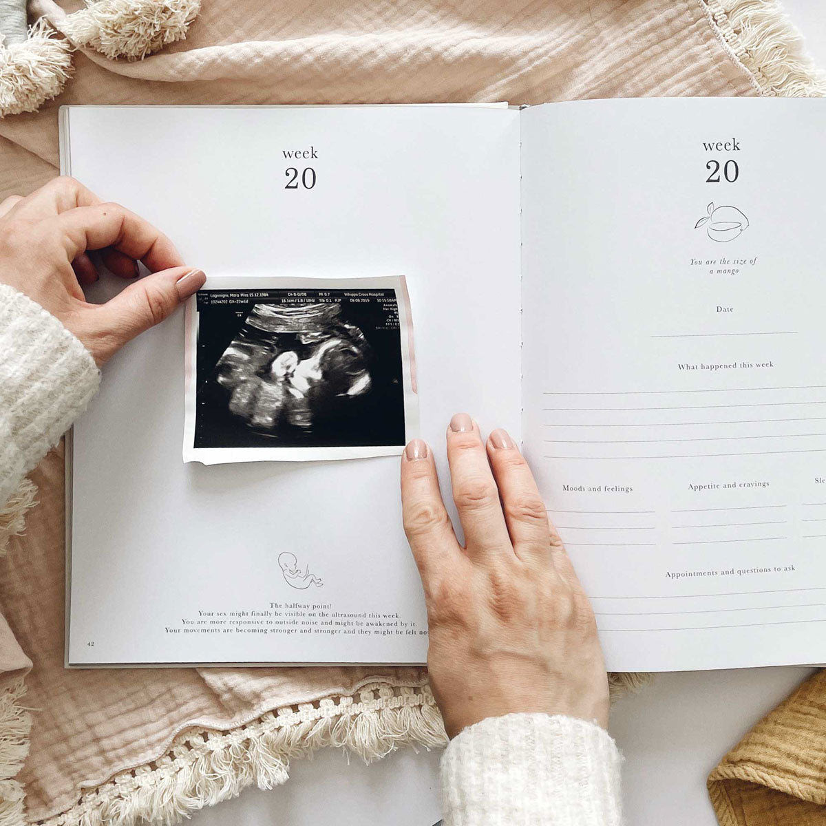 My Pregnancy Journal, Rainbow
